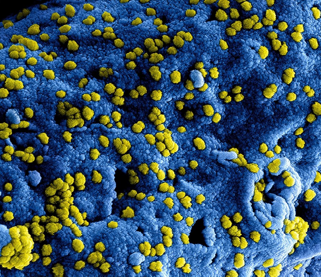 virusbacteria-web Picture of virus